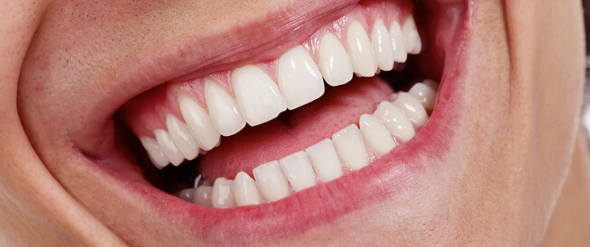 Teeth and mental health. Find out how one affects the other