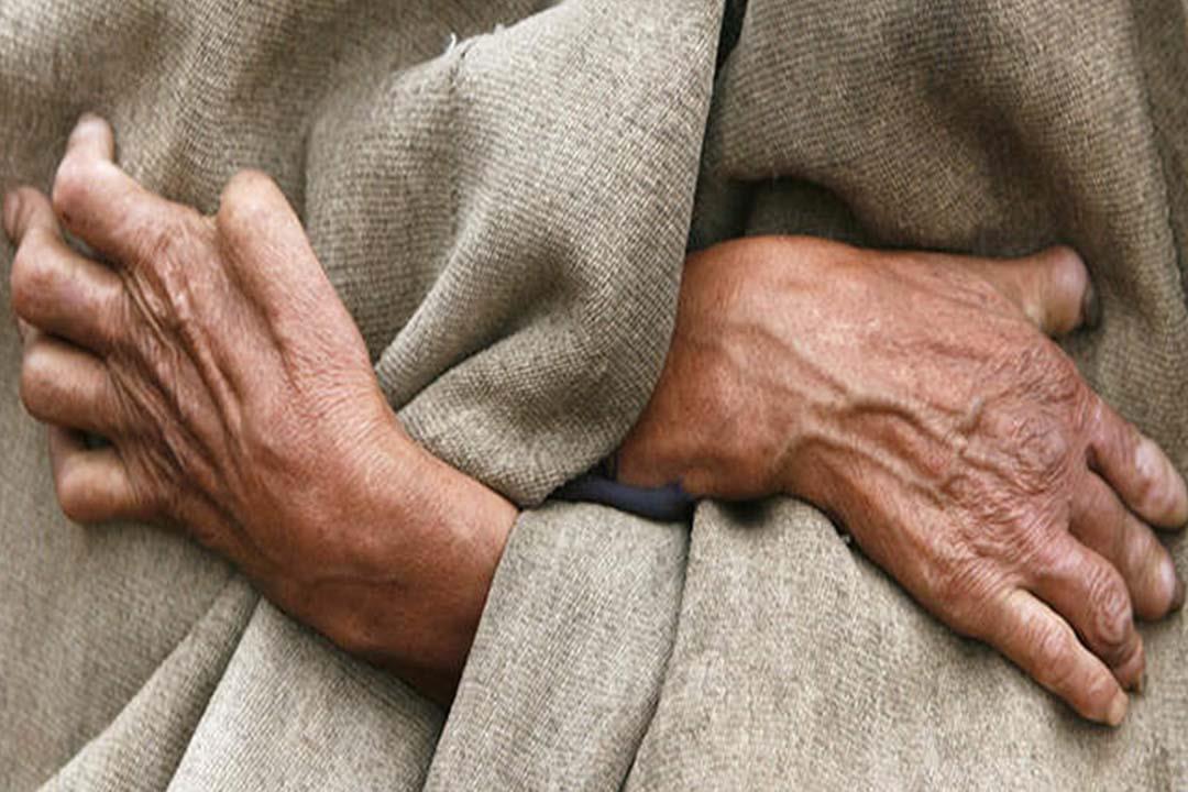 A study demonstrating the effect of leprosy on patients’ mental health